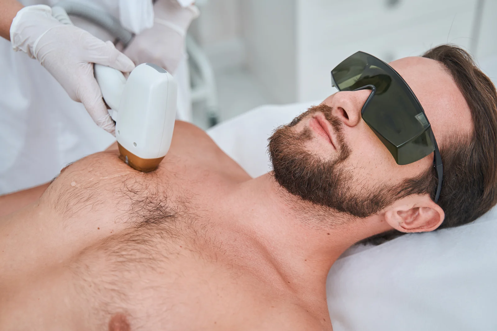 laser hair removal for men