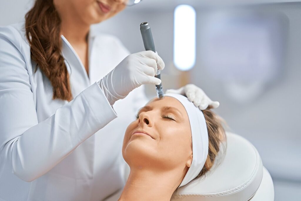 micro needling treatment near you