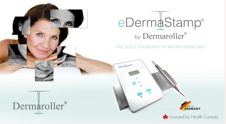 micro needling treatment