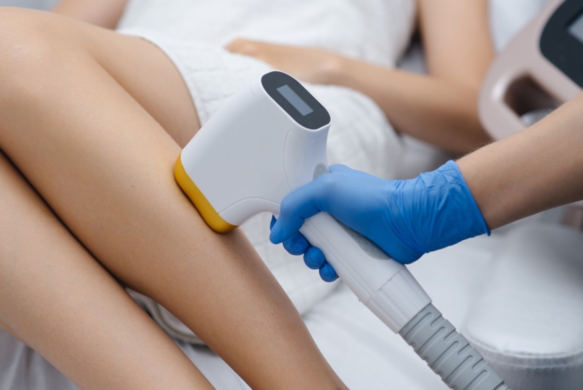 can laser hair removal be permanent