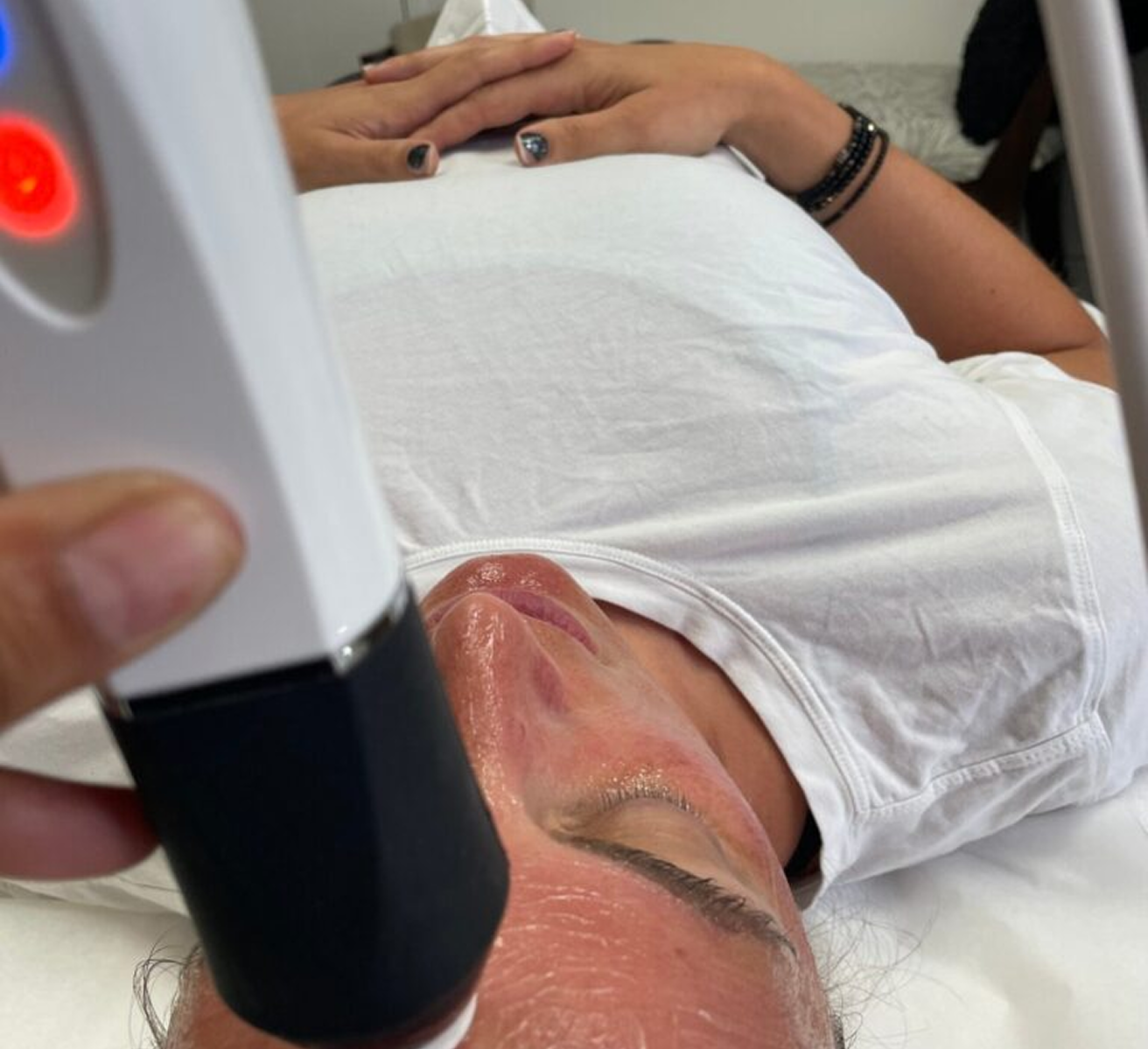 Salicylic Peel